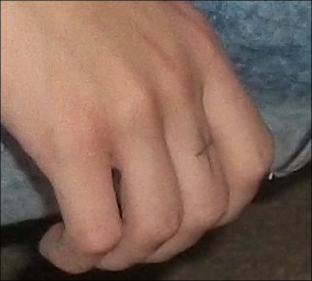 A close-up photograph of a person's hand resting on their lap, showing a small cross tattoo on the pinky finger.