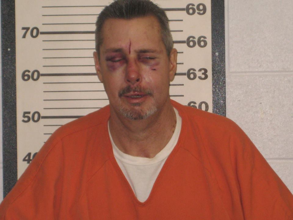 A mugshot of a Caucasian man with short brown hair, a mustache, and a goatee, wearing an orange jail jumpsuit. He has visible facial injuries, including two black eyes and a cut on his forehead. He is standing in front of a height chart.
